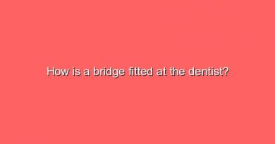 how is a bridge fitted at the dentist 11072