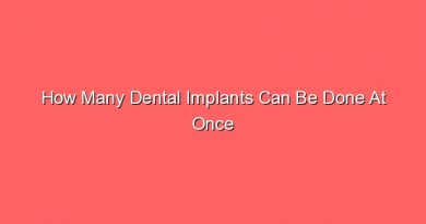 how many dental implants can be done at once 15502