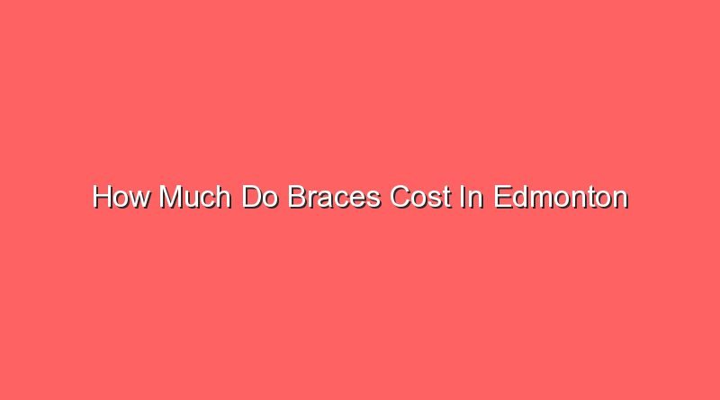 how much do braces cost in edmonton 15821