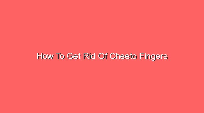 how to get rid of cheeto fingers 13598