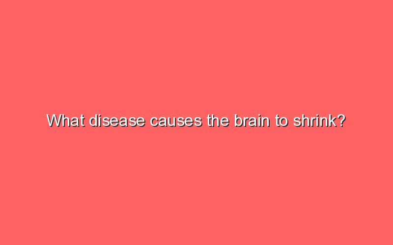 What Disease Causes The Brain To Shrink? - Sonic Hours