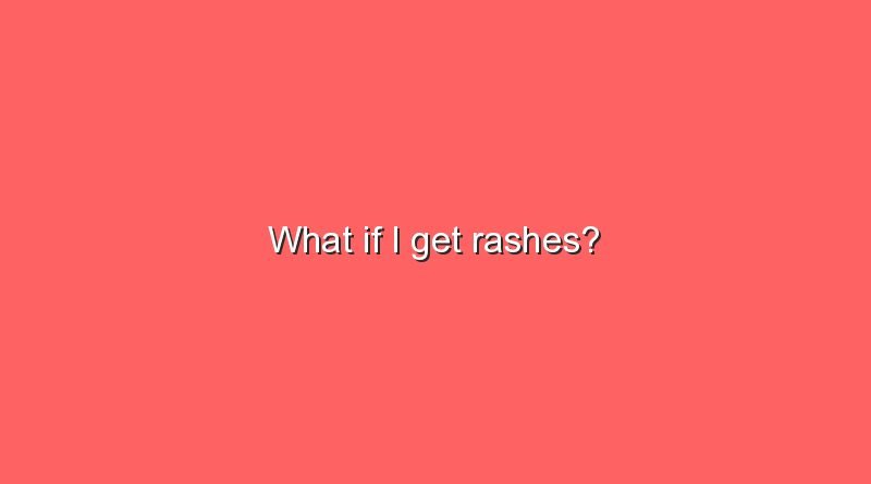 what if i get rashes 11104