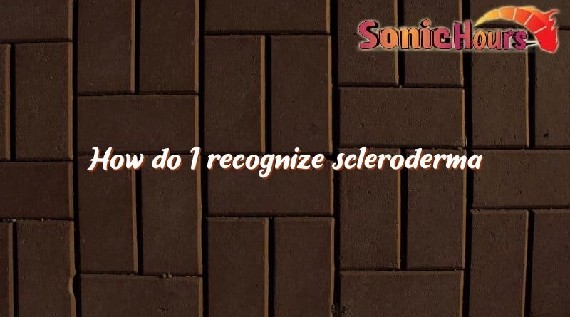 how do i recognize scleroderma 4423