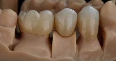 Why Is My Tooth Crown Painful? Your Symptoms Explained